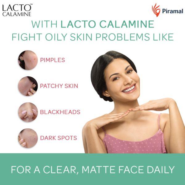 Lacto Calamine Oil Balance Combination to Normal Skin Lotion 30 ml - Face Creams