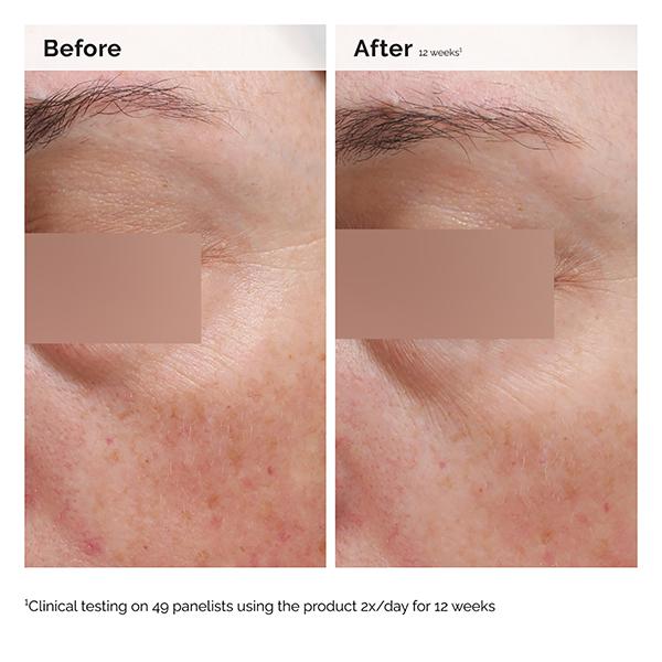 The Ordinary Niacinamide 5% Face & Body Emulsion 100 ml - Face Serum