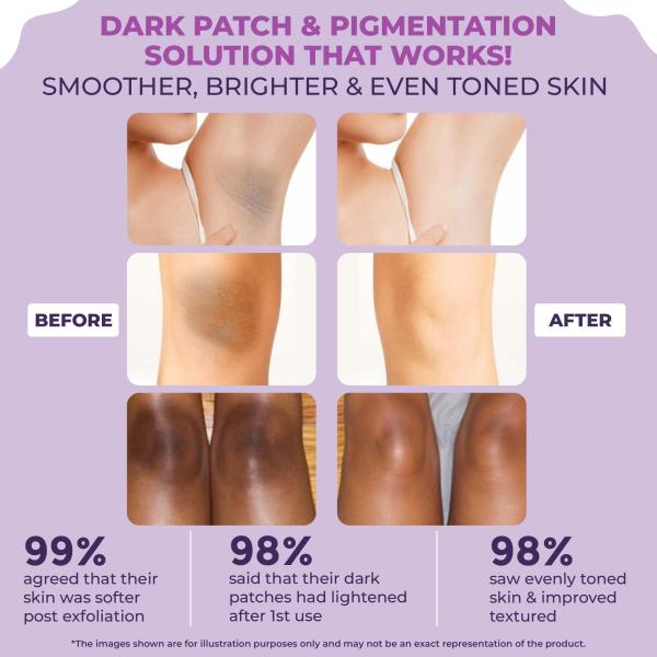 Sanfe Instant Spotlite Mask Lightens Dark Patches in 10 Minutes Exfoliates Dirt and Dead Skin 100 gm - Scrubs & Exfoliants