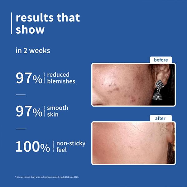 Plum Rice Water & 10% Niacinamide Face Serum - Brightens from 1st Use, Dermat-Tested 50 ml - Face Serum