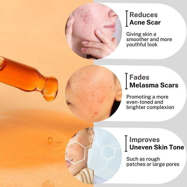 House of Beauty Pigmentation Oil For Pigmented Skin, Reduces Melanin, Uneven Skin Tone 30ml - Face Oils