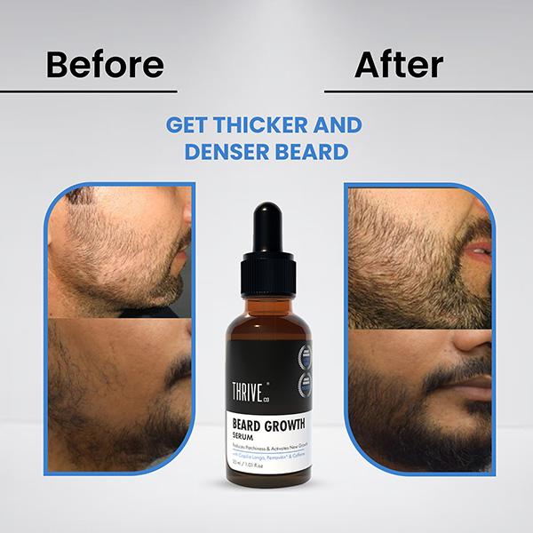 ThriveCo Beard Growth Serum 30 ml - Beard Serum