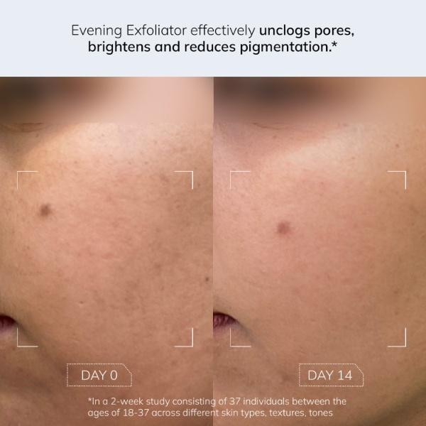 FAE Beauty Evening Exfoliator - Gentle Bi-Phasic Exfoliating Toner 100 ml - Face Mists