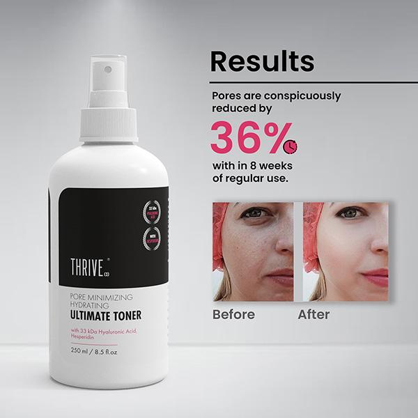 Thriveco Pore-Minimizing Ultimate Toner 250 ml - Toners