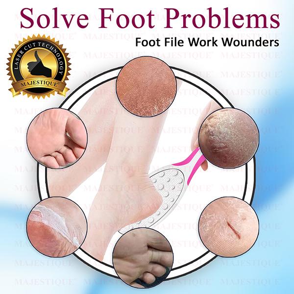 Majestique Dual Side Foot Scrubber, Heel Scraper for Feet, Hands, and Body - Color May Vary 1's - Callus Shavers & Stones