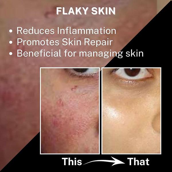 House of Beauty Super Boost Fishy Oil-Dry & Mature Skin For Hydration & Glow with Omega-3 10ml - Face Oils