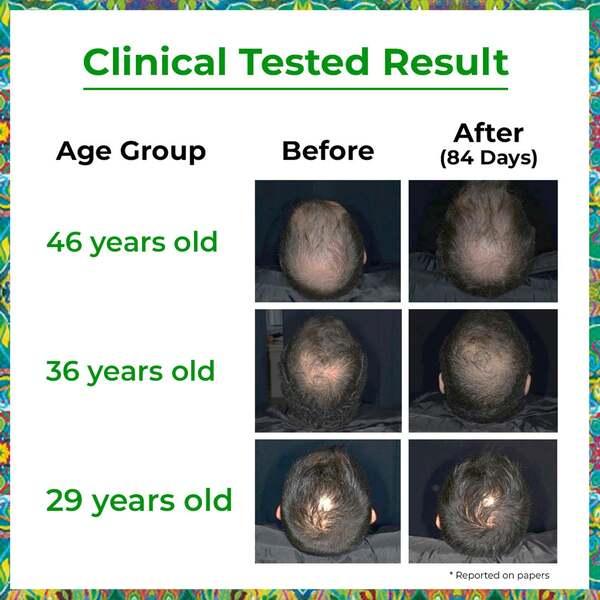 Passion Indulge Rosemary Hair Growth Serum with Redensyl, Water Based Hair Serum for Hair Growth 50 ml - Hair Serums