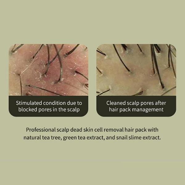 Lador Tea Tree Scalp Clinic Hair Pack 200 ml - Hair Masks & Packs