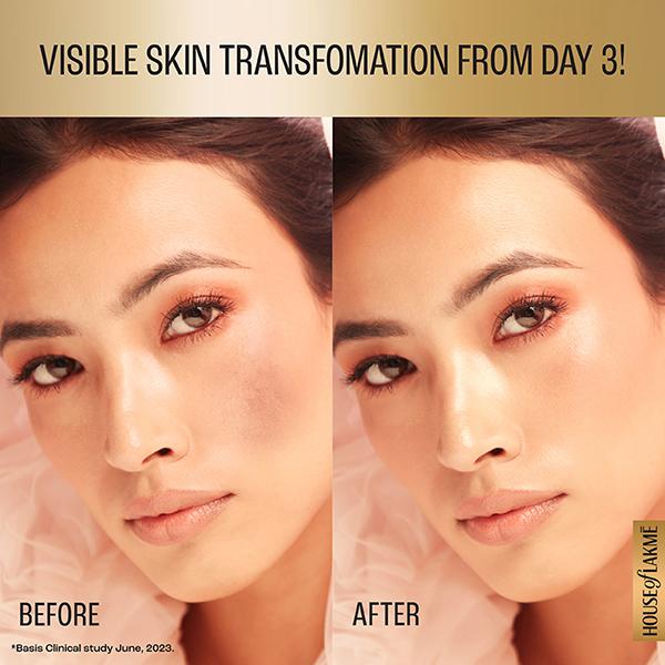 Lakme Absolute Perfect Radiance Serum with Vita Resorcinol 30 ml - Face Serum