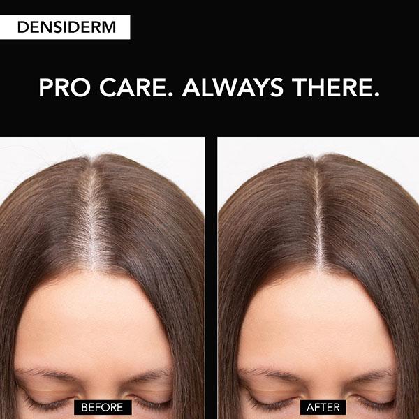 O3+ Women Densiderm Hair Growth Serum Scalp Spray with Ginseng Hair Fall Control & Hair Growth 50 ml - Hair Serums