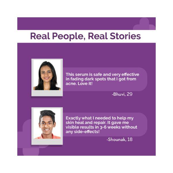 The Derma Co. 2 Percent Alpha Arbutin Face Serum for Dark Spots & Uneven Skin Tone 30ml - Face Serum