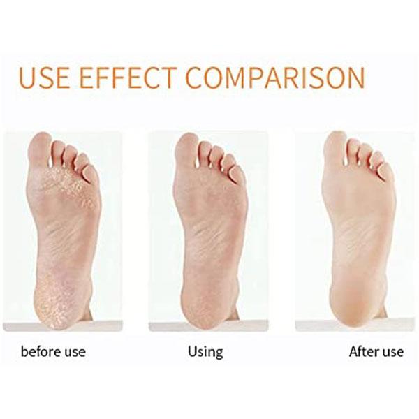 Majestique Foot Callus Remover, Deluxe Pedicure Spa Treatment - Multicolor 1's - Manicure & Pedicure Kits