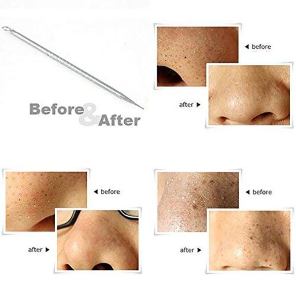 Bronson Professional Black head remover tool pointed 1's - Nail Care