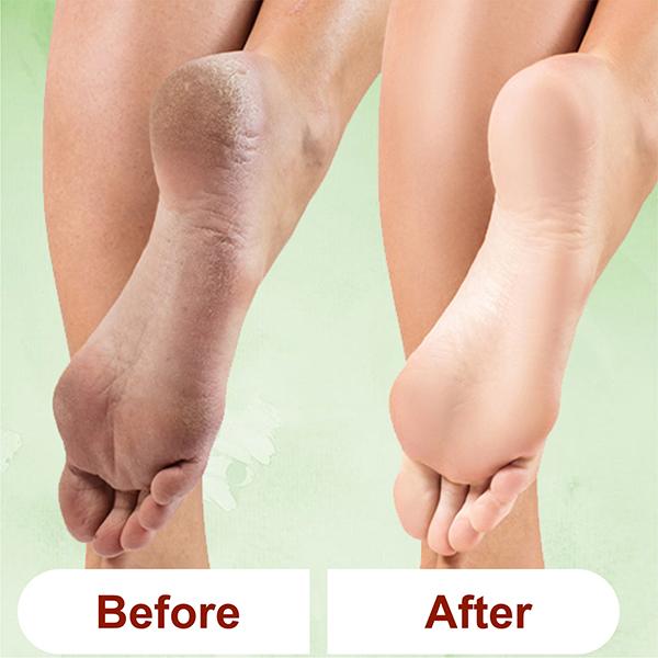 Kazarmaa Lemon Grass Foot Scrub And Foot Scrubber Tool 250 gm - Foot Scrubs