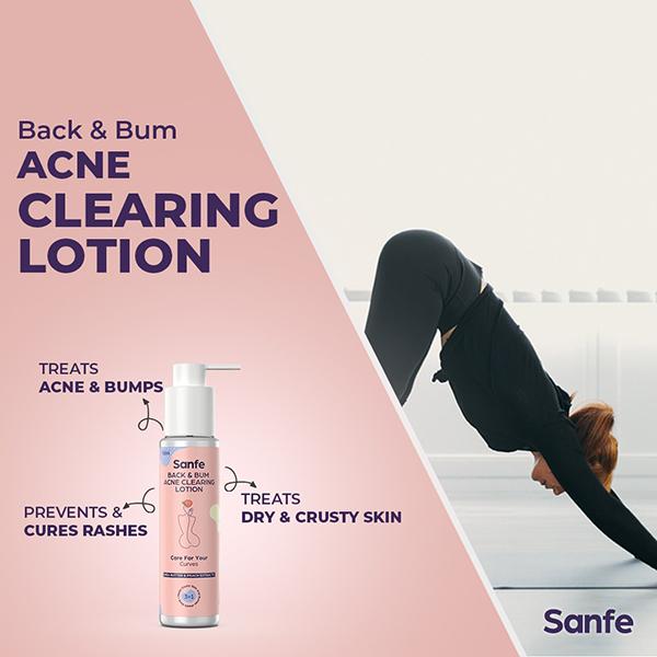 Sanfe Back & Bum Acne Clearing Lotion - Shea Butter & Peach Extracts 100 ml - Lotions & Creams