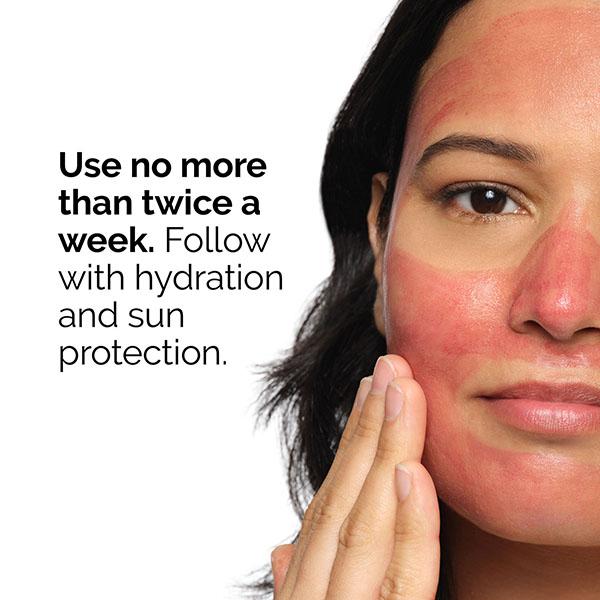 The Ordinary AHA 30% + BHA 2% Peeling Solution 30 ml - Masks & Peels