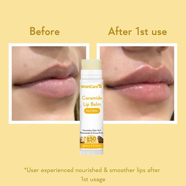 WishCare Ceramide Lip Balm with SPF50 PA+++ - Kojic Acid & Niacinamide - For Lip Lightening 5 gm - Lip Balms