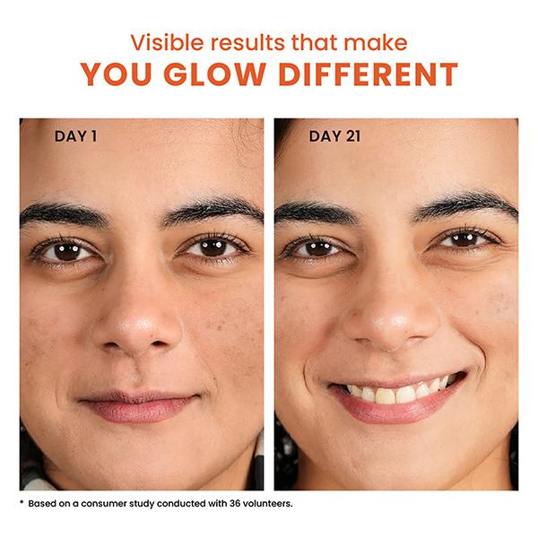 Foxtale Eternal Light - Brightening Serum With 10% Vitamin C & Glutathione 30 ml - Face Serum