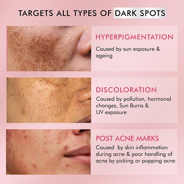 Mcaffeine 2% Kojic Acid and 1% Niacinamide De-Pigmentation Cream All Skin Tone 50 gm - Face Moisturizers