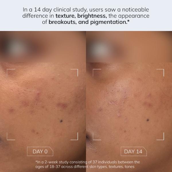 FAE Beauty Evening Exfoliator - Gentle Bi-Phasic Exfoliating Toner 100 ml - Face Mists