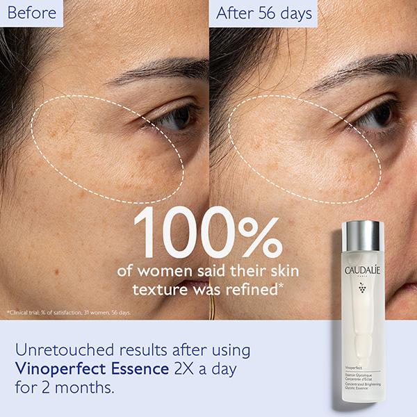 Caudalie Vinoperfect Concentrated Brightening Glycolic Essence 150 ml - Toners