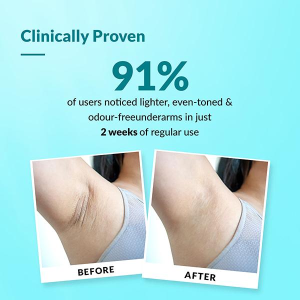 Fixderma Nigrifix Underarm Ocean Roll on - Brightens Skin & Exfoliates Underarm 60 ml - Deodorants/Roll-Ons