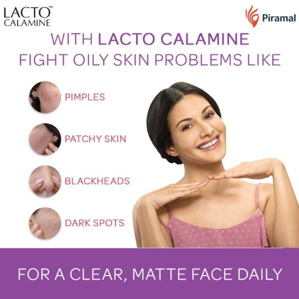 Lacto Calamine Oil Balance for Oily Skin Lotion 120 ml - Lotions & Creams