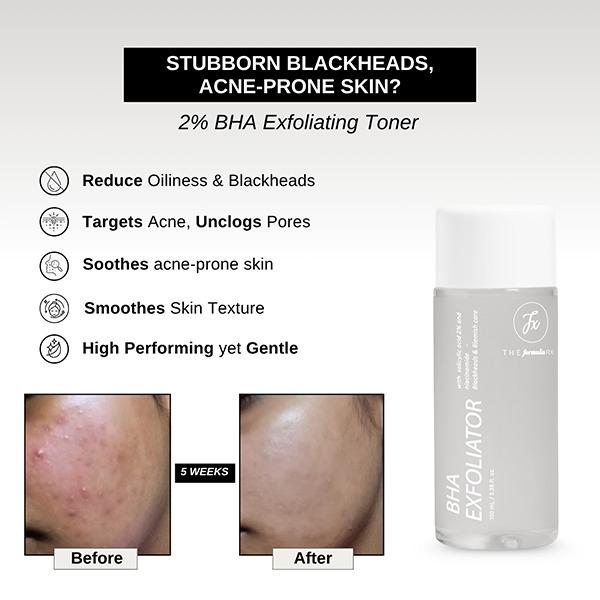 The Formularx 2% BHA Exfoliator with 2% Salicylic Acid and 2% Niacinamide for Blackheads, Acne, Oily Skin 100 ml - Scrubs & Exfoliants