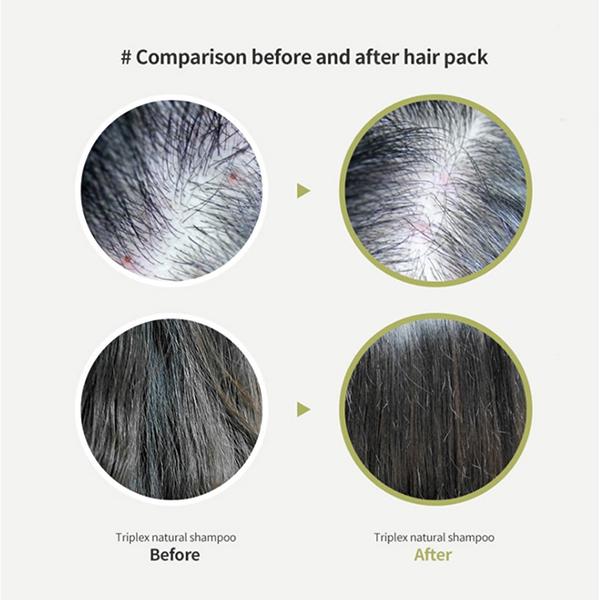 Lador Tea Tree Scalp Clinic Hair Pack 200 ml - Hair Masks & Packs