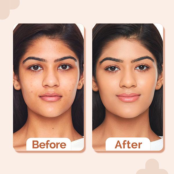 The Derma Co. 2% Niacinamide High Coverage Foundation,1% Hyaluronic Acid and SPF 40 PA+++ for 12 Hr- 05 Peach 30 gm - Foundation