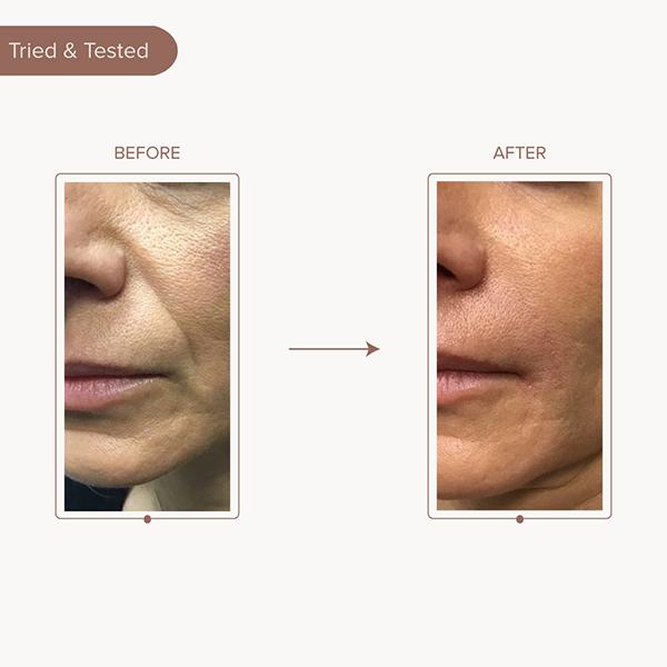 Dromen and Co Lifting and Firming Undereye and Cheek Strips 1's - Sheet Masks