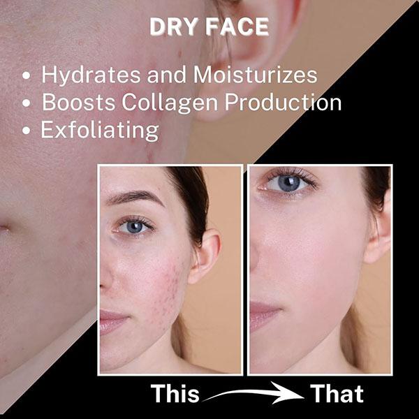 House of Beauty Hibiscus Oil For Hairfall, Soft Skin, Aids Psoriasis For Body & Hair 200ml - Hair Oils