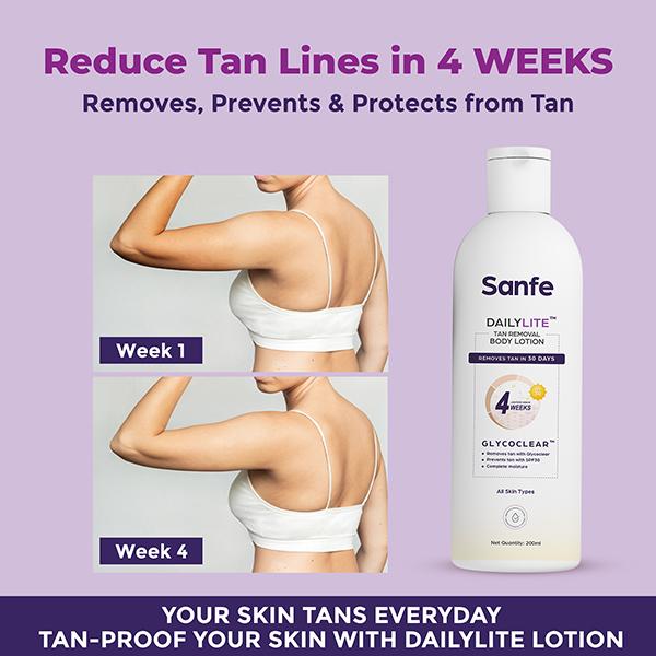 Sanfe Dailylite Tan Removal Body Lotion for Women Detan Non-Sticky Removes and Prevents Tan SPF 30 200 ml - Creams, Lotions & Oils