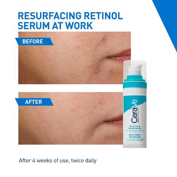 CeraVe Blemish Control Cleanser 236 ml - Face Scrubs