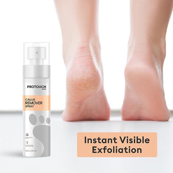 Protouch Callus Remover Spray, Potent Formula to Remove the Tough Dead skin and Reveal Soft Heels 100 ml - Foot Scrubs