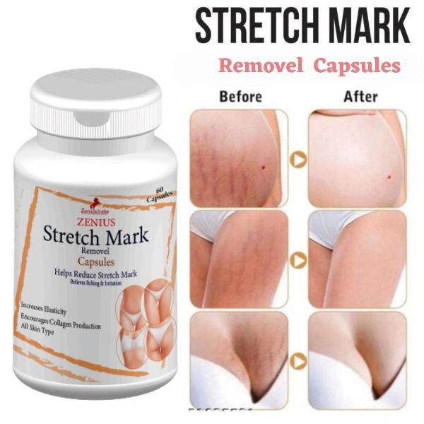 Zenius Stretch Mark Removel Capsule 60's - Other Supplements