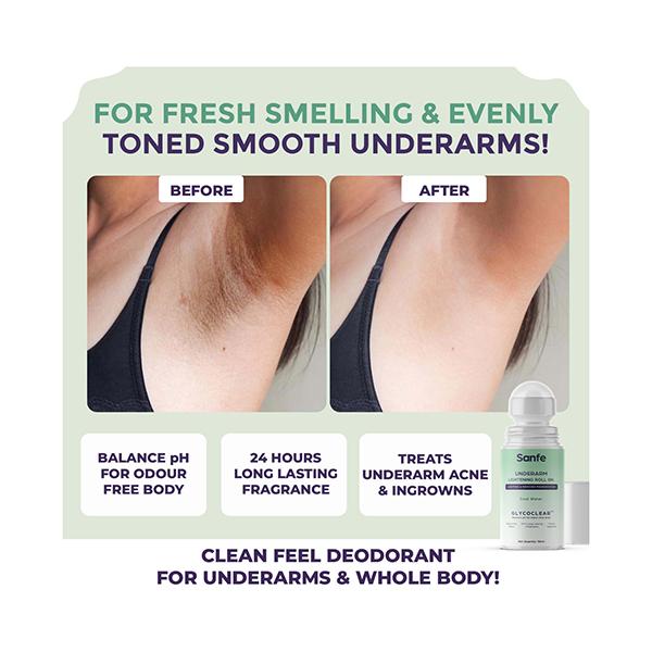 Sanfe Underarm Lightening Roll On for Women, For Underarms, Lightens & Remove Pigmentation, Deodorant for Underarms, Glycoclear Technology 50 ml - Intimate Care
