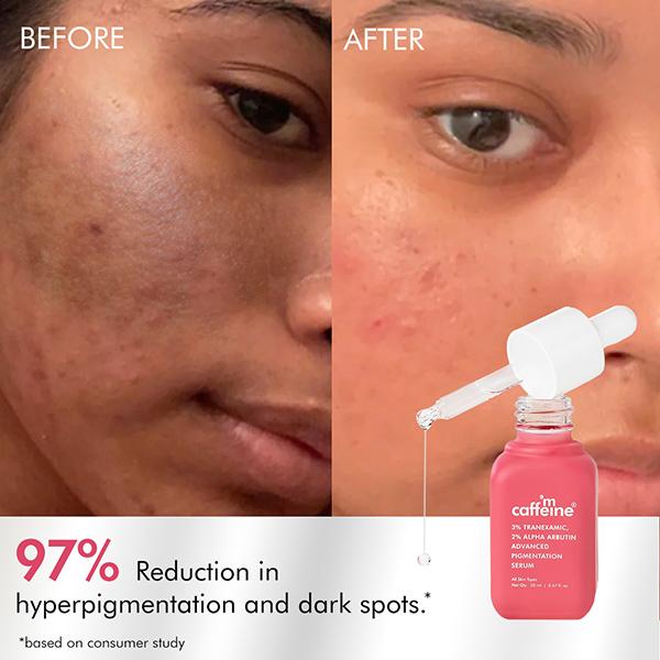 Mcaffeine Clear Glow 3% Tranexamic, 2% Alpha Arbutin Advanced Pigmentation Serum Treatment 20 ml - Face Serum