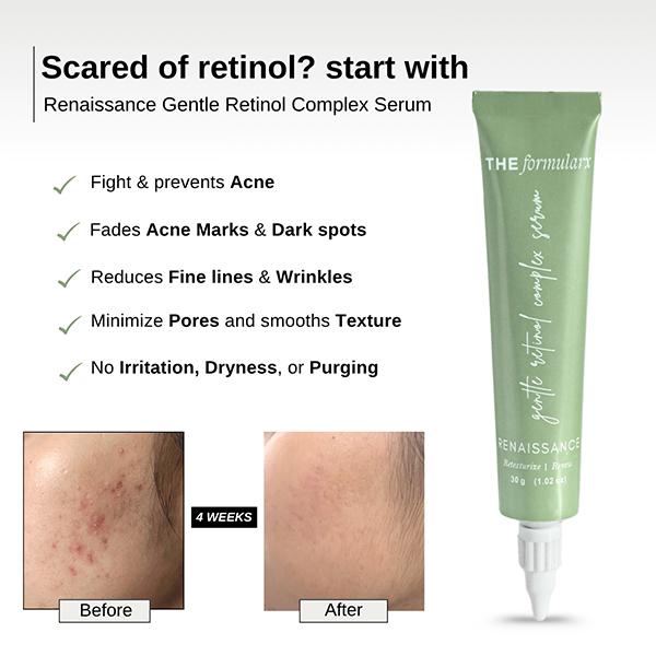 The Formularx Gentle Retinol Night Serum for Acne, Dark Spots, Enlarged Pores & Anti-Aging 30 gm - Face Serum