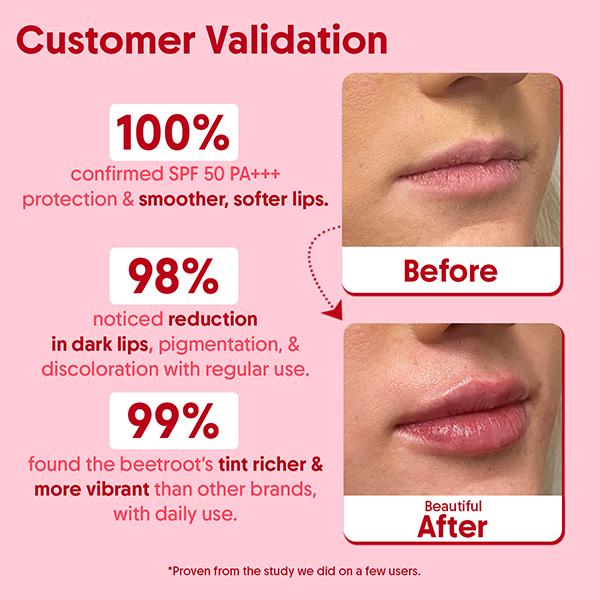 Aravi Organic Lip Glowy Balm with SPF 50 PA Plus Kojic Acid and Ceramide for Lip Brightening  5 gm - Lip Balms
