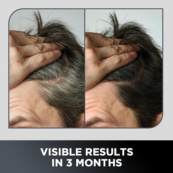 The Man Company Anti-Graying 2-In-1 Formula Shampoo & Conditioner 200ml - Shampoos