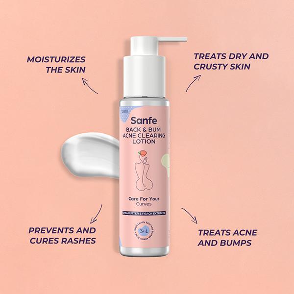 Sanfe Back & Bum Acne Clearing Lotion - Shea Butter & Peach Extracts 100 ml - Lotions & Creams