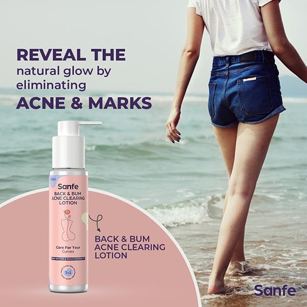 Sanfe Back & Bum Acne Clearing Lotion - Shea Butter & Peach Extracts 100 ml - Lotions & Creams