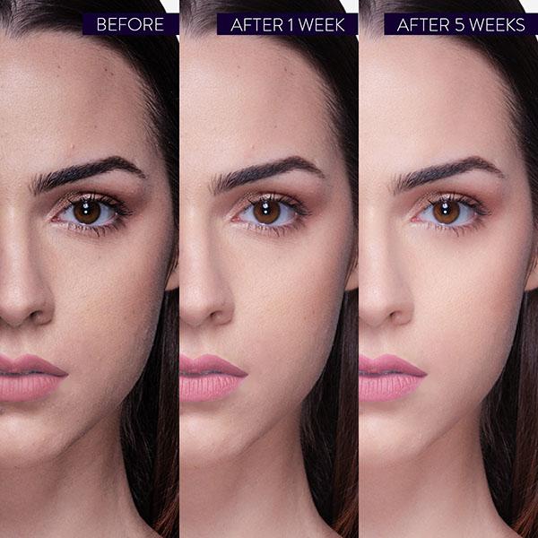 Belora Paris Serum Superb Skin (Serum Superbe Peau) 20 ml - Face Gels