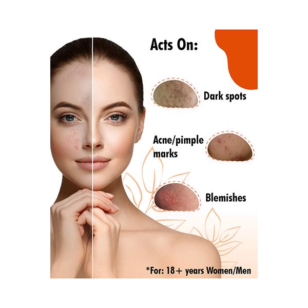 Urban Yog Anti-Pigmentation Serum With 10% Niacinamide 1% Zinc Pca Face Serum 30 ml - Face Oils
