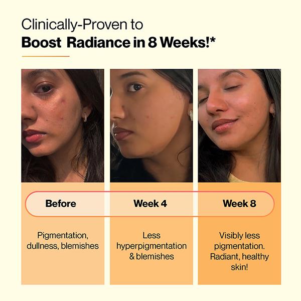 Setu Skin Renew - 15 Effervescent Tablets, Glutathione With Vitamin C, Gluta Fizz, Mixed Berry Flavour 1's - Multi-Vitamins