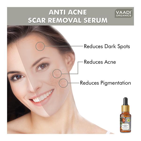 Vaadi Herbals 100% Pure Essential Oil - Anti Acne Scar Removal Serum with Sandalwood Oil 10 ml - Essential Oils