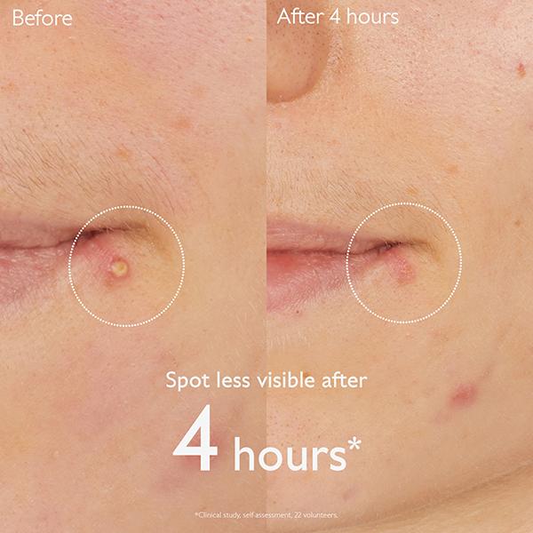 Caudalie Vinopure Salicylic Spot Solution 15 ml - Face Moisturizers