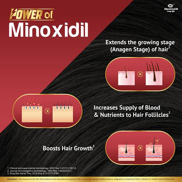 Chekfall 5% Solution 60ml - Hair Loss-Oth