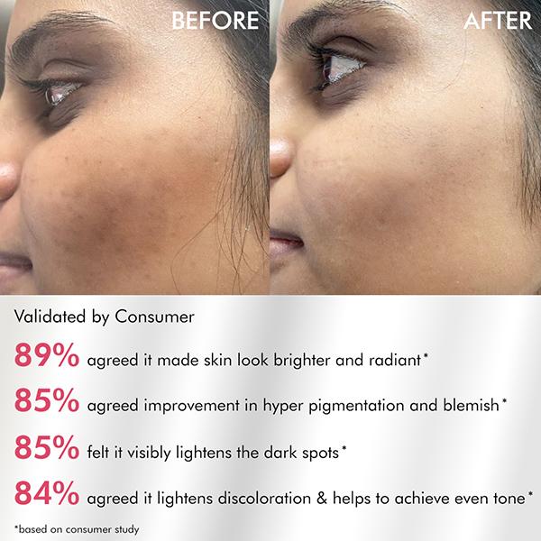 Mcaffeine Clear Glow 2% Alpha Arbutin Kojic Acid Brightening Serum Pads with 3% Niacinamide 40's - Face Serum